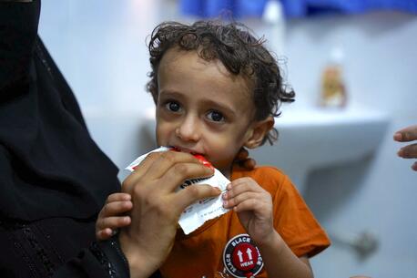 At Al-maidan Health Center in Aden, Yemen, 3-year-old Ali eats from a packet of Ready-to-Use Therapeutic Food supplied by UNICEF.