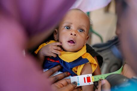 A child is screened for malnutrition at Beet Elshabab internally displaced people's (IDP) camp in Port Sudan on Oct. 22, 2024. 