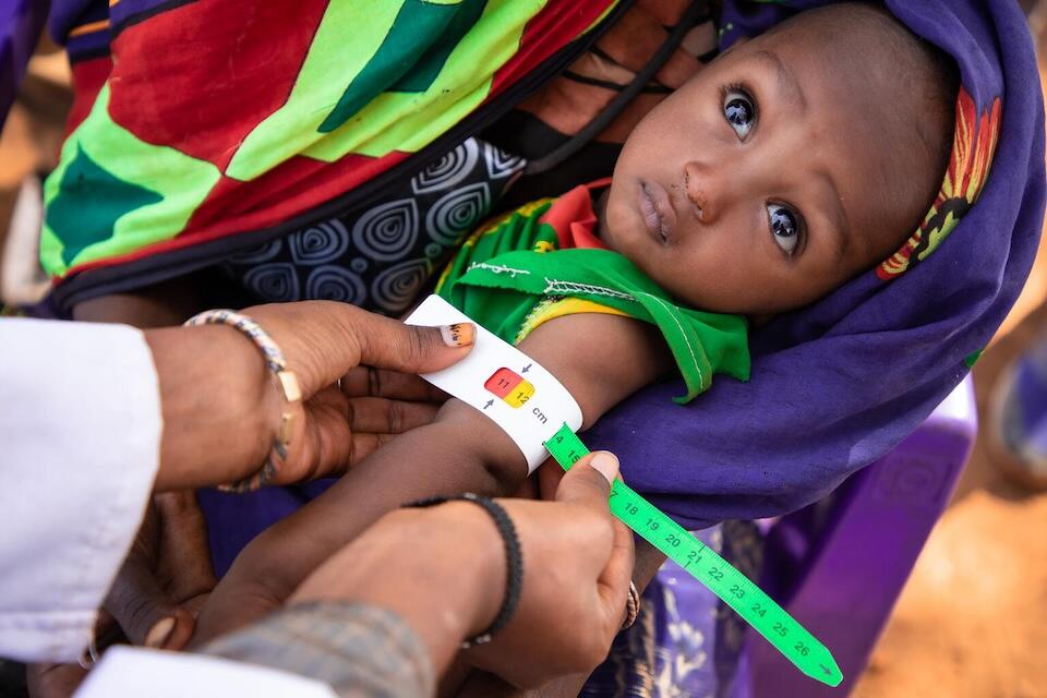 A baby is screened for malnutrition by a UNICEF-supported health worker at Dubluk IDP camp in Ethiopia. 