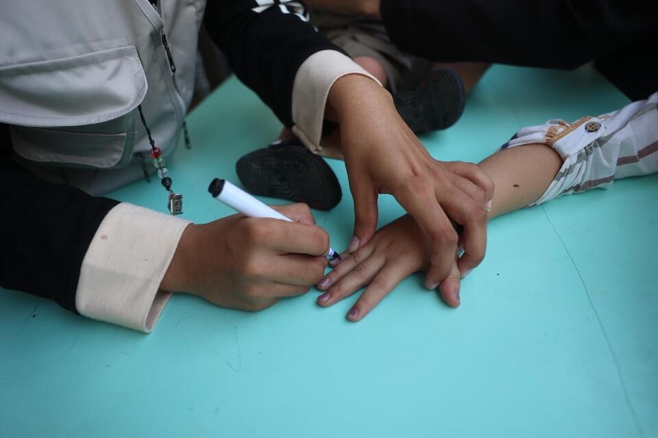 After a child receives their polio vaccine, their finger is marked to show they've been vaccinated.