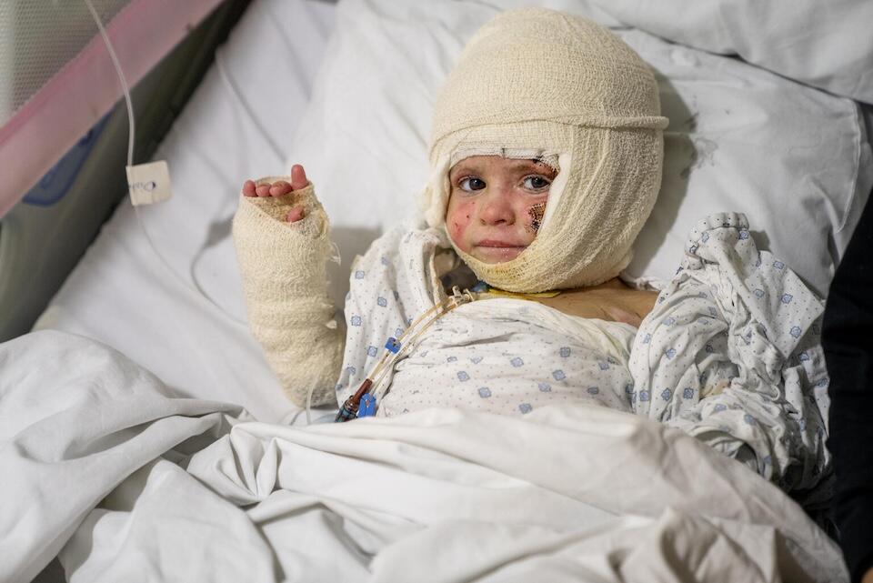 Two-year-old Ivana was severely burned when her family's house caught fire after a nearby air strike in Deir Qanoun al-Nahr, Tyre district, southern Lebanon.